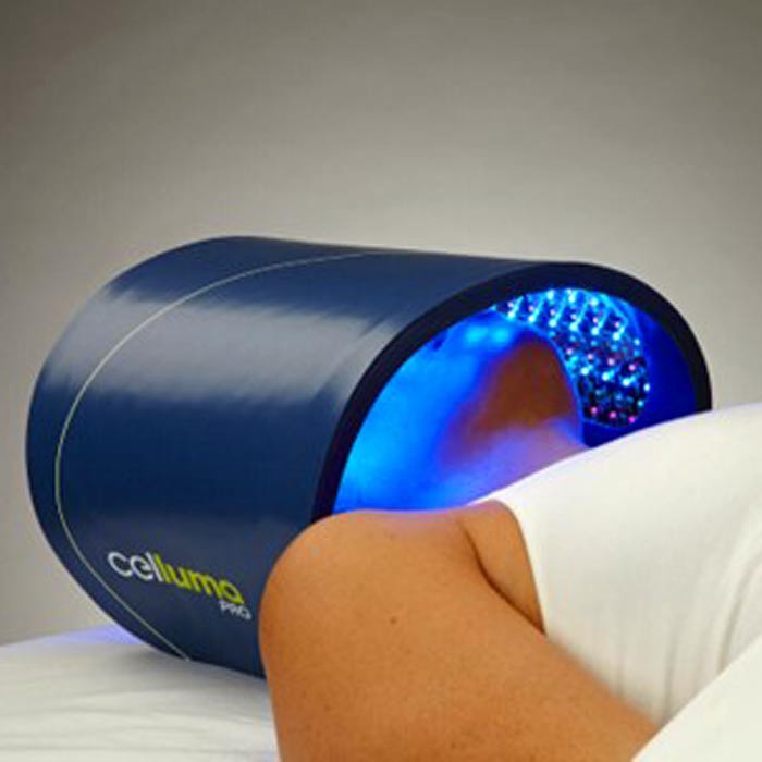 Microneedling mit Dermapen 4™ - Behandlung auf der Liege
