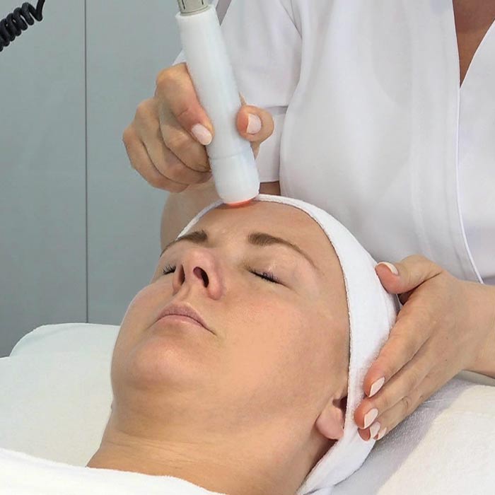 coldPLASMA Behandlung an Kundin